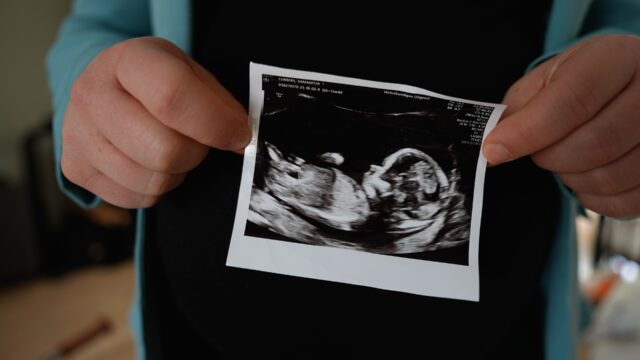 Dromen over je baby 💭  Heb je echo beelden van de kleine? Dat mag natuurlijk niet ontbreken in de zwangerschapsfilm. Het blijft toch magisch wat je al kan zien op het scherm (en hoe snel de techniek gaat!) 🧸